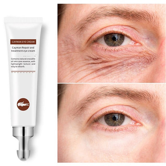 Anti-wrinkles Magical Eye Cream