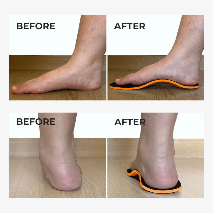 Ortho Flexx Shoes Insole for knee & foot pain relief